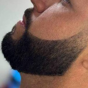 Barba + Pigmentação